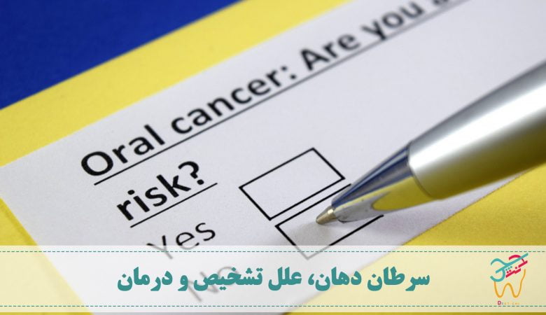 سرطان دهان، علت سرطان دهان و درمان سرطان دهان