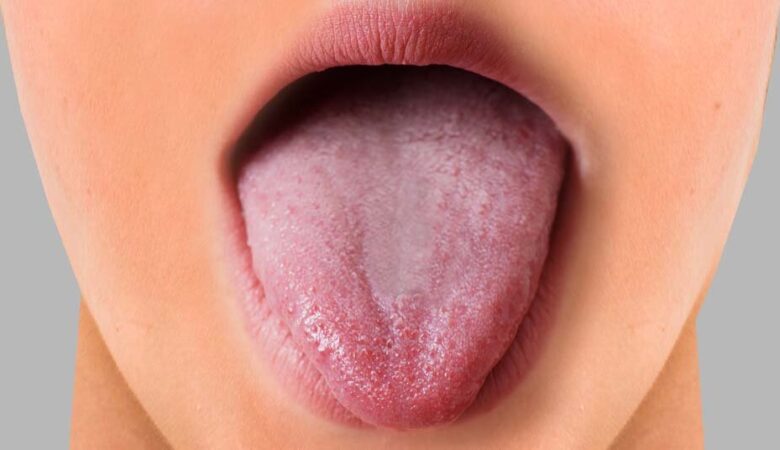 علل ایجاد زخم یا التهاب جوانه‌های چشایی زبان چیست؟