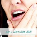 انتشار عفونت دندان در بدن و پخش شدن عفونت بدن در سایر اندام ها