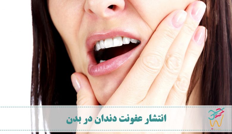 انتشار عفونت دندان در بدن و پخش شدن عفونت بدن در سایر اندام ها