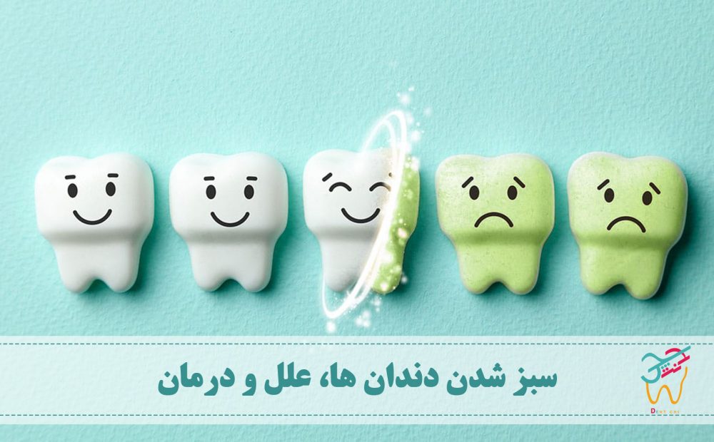 سبز شدن دندان ها ممکن است برای دندان های شیری یا دائمی اتفاق بیفتد. این تغییر رنگ علاوه بر این که ظاهر دندان ها را خراب می کند ممکن است نشان دهنده ی یک بیماری زمینه ای نیز باشد.