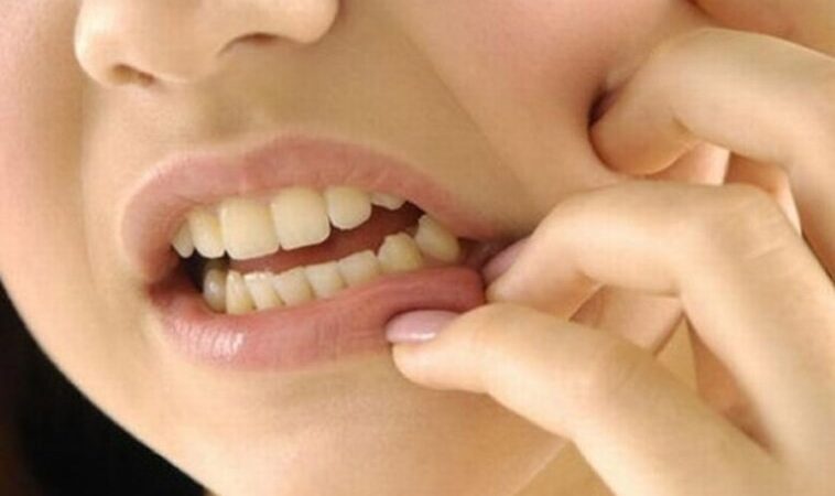 احساس خارش در دندان‌ها: دلایل و راه‌های درمان