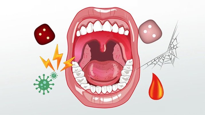 انواع بیماری‌های دهان و دندان