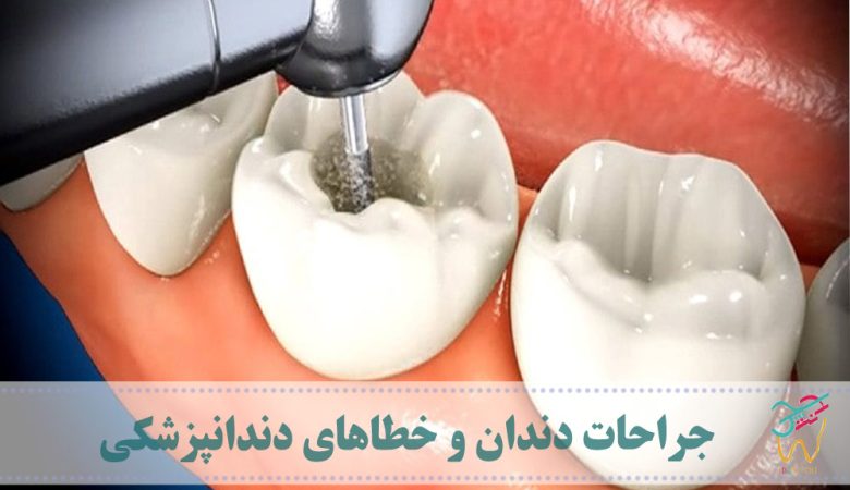 جراحات دندان و خطاهای دندانپزشکی