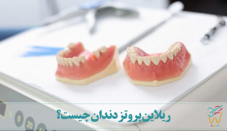 ریلاین پروتز دندان چیست؟