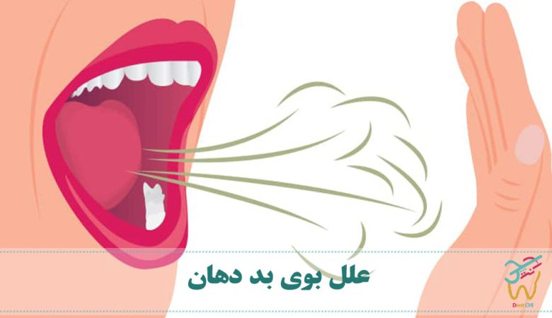 علل بوی بد دهان