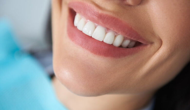 باندینگ دندان چیست؟