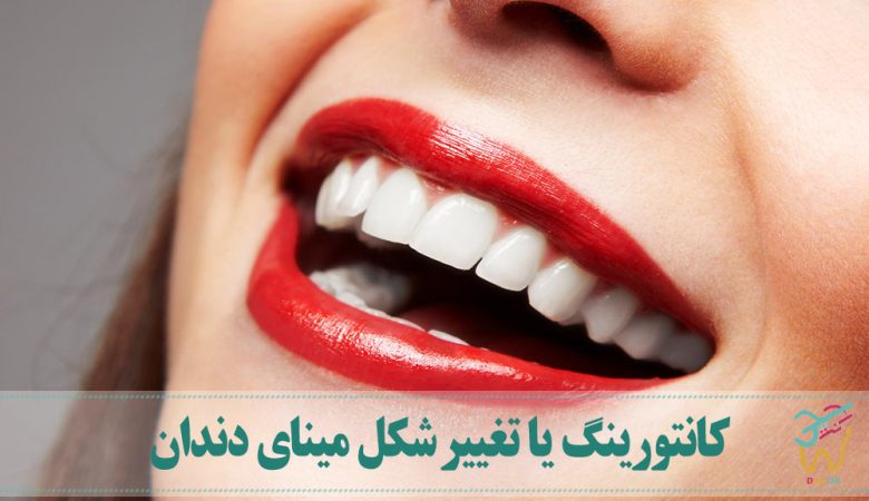کانتورینگ یا تغییر شکل مینای دندان