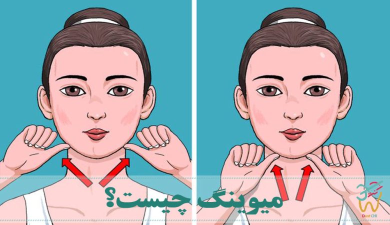 میوینگ چیست؟