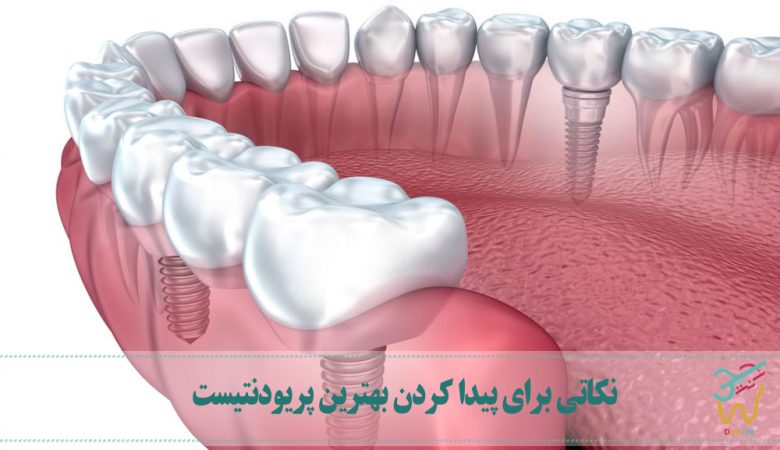 نکاتی برای پیدا کردن بهترین پریودنتیست