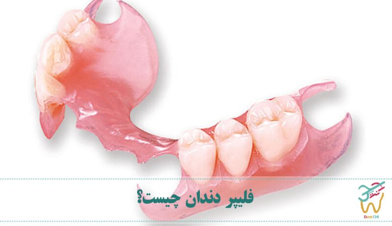فلیپر دندان چیست؟