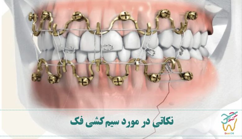 نکاتی در مورد سیم کشی فک