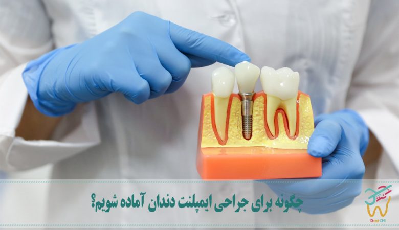 آماده سازی برای جراحی ایمپلنت دندان