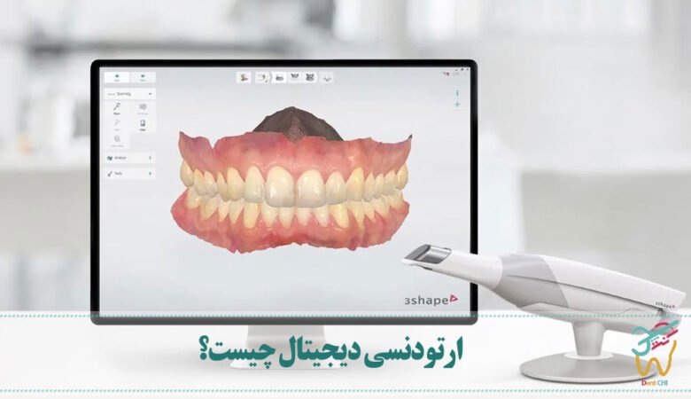 ارتودنسی دیجیتال چیست؟