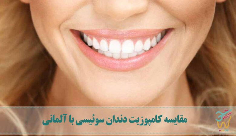 مقایسه کامپوزیت دندان سوئیسی با آلمانی