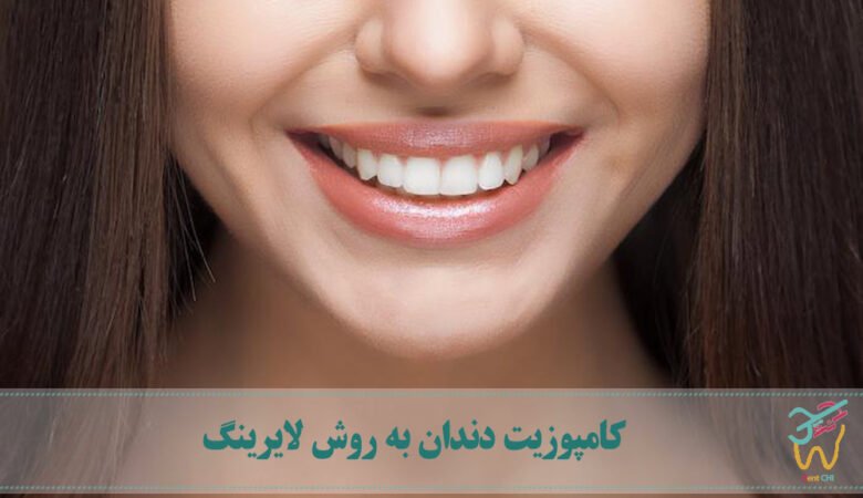 کامپوزیت دندان به روش لایرینگ