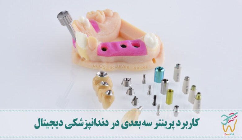 کاربرد پرینتر سه بعدی در دندانپزشکی دیجیتال