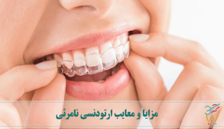 مزایا و معایب ارتودنسی نامرئی