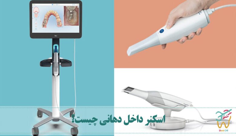 اسکنر داخل دهانی چیست؟