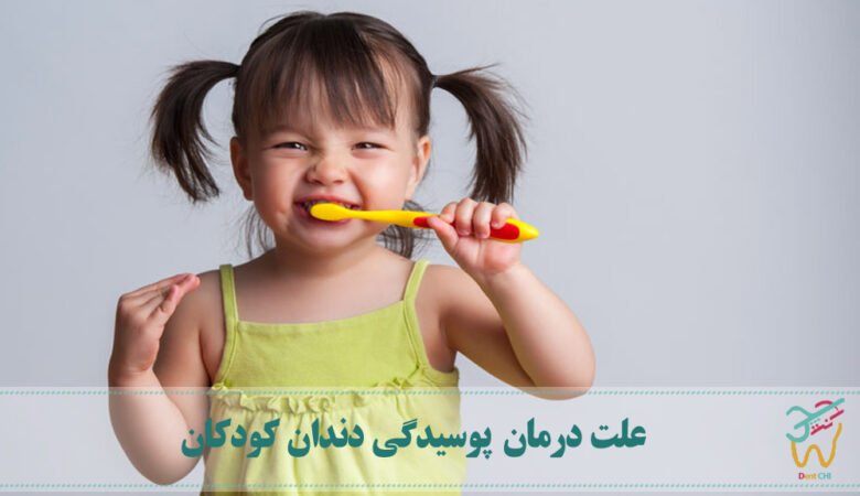 چرا دندانپزشکان پوسیدگی دندان کودکان را درمان می‌کنند؟