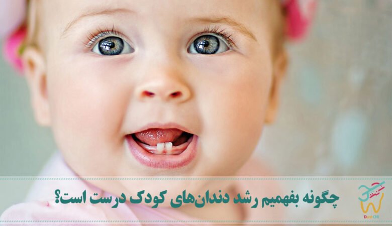 چگونه بفهمیم رشد دندان‌های کودک درست است؟