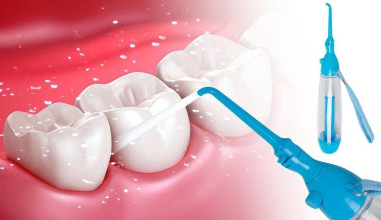 تاثیر واتر جت بر دندان کامپوزیت شده