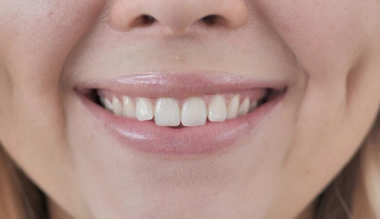 بهبود سلامت دهان با تغییر شکل مینای دندان