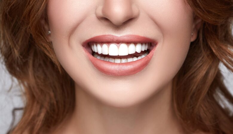 انواع روش‌های زیبایی دندان‌ها