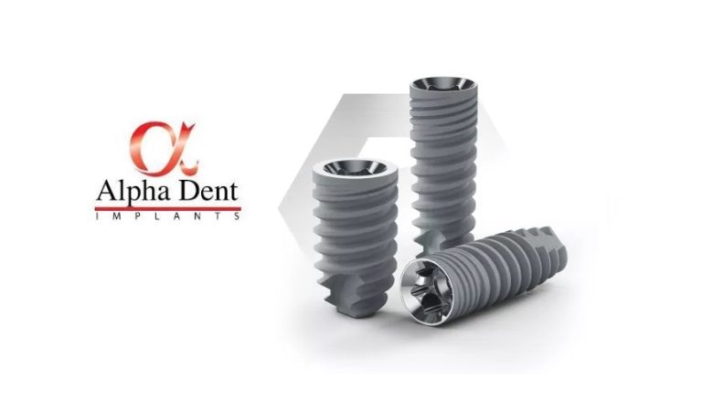 ایمپلنت آلفادنت