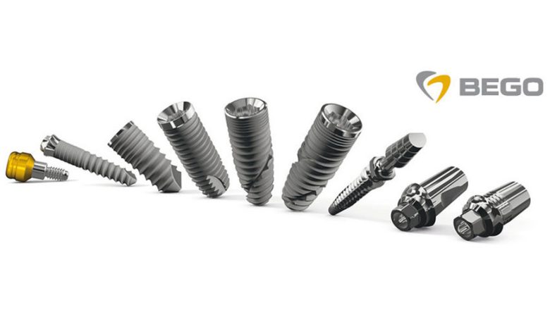 ایمپلنت بگو