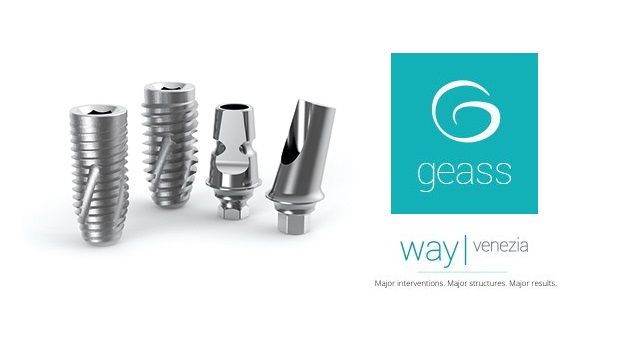 ایمپلنت geass