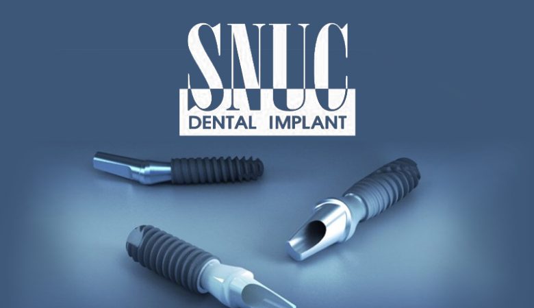 ایمپلنت Snucone