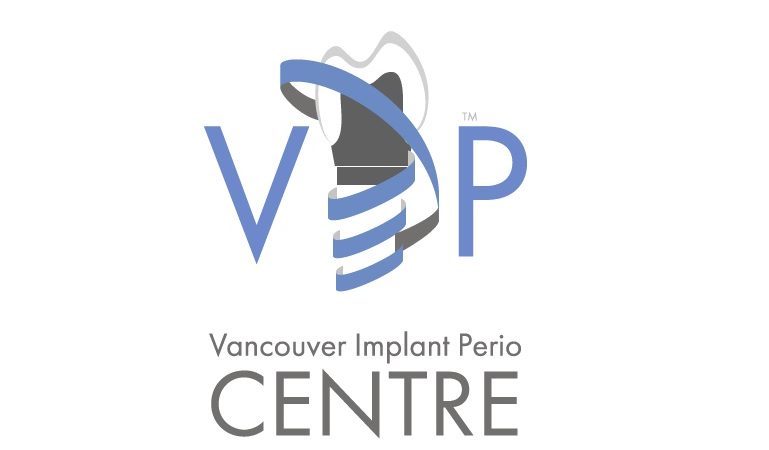 مرکز ایمپلنت پریو در ونکوور